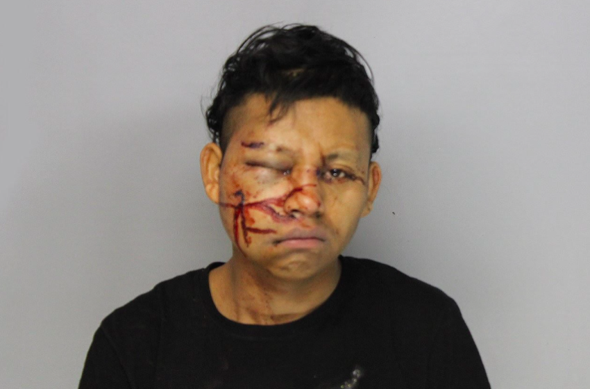 Armed Robbery Suspect Taken Into Custody After Slipping and Falling On Ice While Trying To Flee